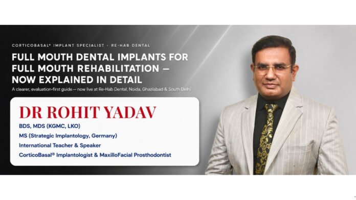 𝗙𝘂𝗹𝗹 𝗠𝗼𝘂𝘁𝗵 𝗗𝗲𝗻𝘁𝗮𝗹 𝗜𝗺𝗽𝗹𝗮𝗻𝘁𝘀 𝗳𝗼𝗿 𝗙𝘂𝗹𝗹 𝗠𝗼𝘂𝘁𝗵 𝗥𝗲𝗵𝗮𝗯𝗶𝗹𝗶𝘁𝗮𝘁𝗶𝗼𝗻 𝗡𝗼𝘄 𝗘𝘅𝗽𝗹𝗮𝗶𝗻𝗲𝗱 𝗶𝗻 𝗗𝗲𝘁𝗮𝗶𝗹 𝗯𝘆 Dr Rohit Yadav 𝗮𝘁 𝗥𝗲-𝗛𝗮𝗯 𝗗𝗲𝗻𝘁𝗮𝗹